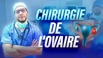 chirurgie de l'ovaire