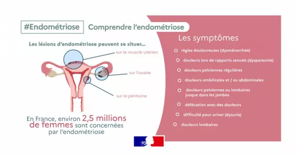infographie endométriose ministère de la sante