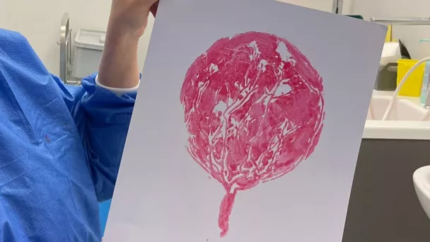 placenta